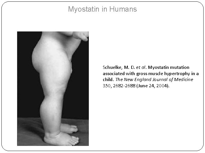 Myostatin in Humans Schuelke, M. D. et al. Myostatin mutation associated with gross muscle