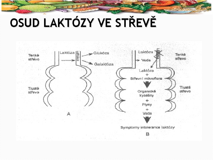 22 OSUD LAKTÓZY VE STŘEVĚ 