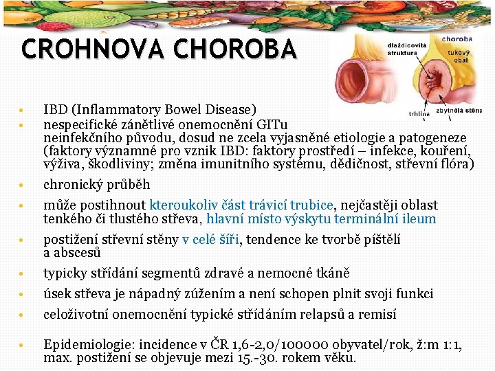 26 CROHNOVA CHOROBA • • IBD (Inflammatory Bowel Disease) nespecifické zánětlivé onemocnění GITu neinfekčního