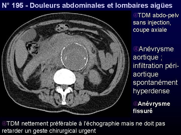 N° 195 - Douleurs abdominales et lombaires aigües TDM abdo-pelv sans injection, coupe axiale