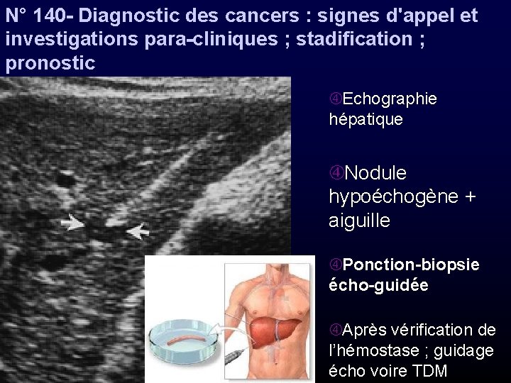 N° 140 - Diagnostic des cancers : signes d'appel et investigations para-cliniques ; stadification