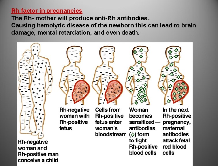 Rh factor in pregnancies The Rh- mother will produce anti-Rh antibodies. Causing hemolytic disease