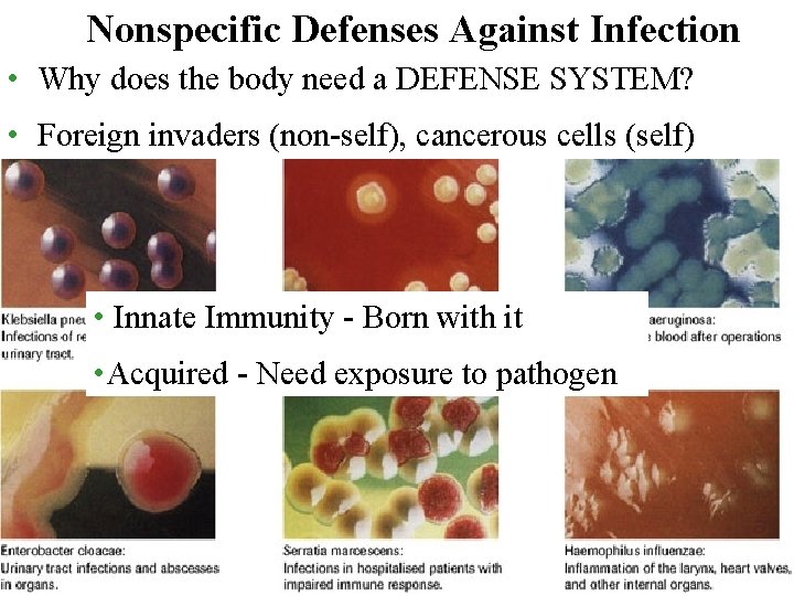 Nonspecific Defenses Against Infection • Why does the body need a DEFENSE SYSTEM? •