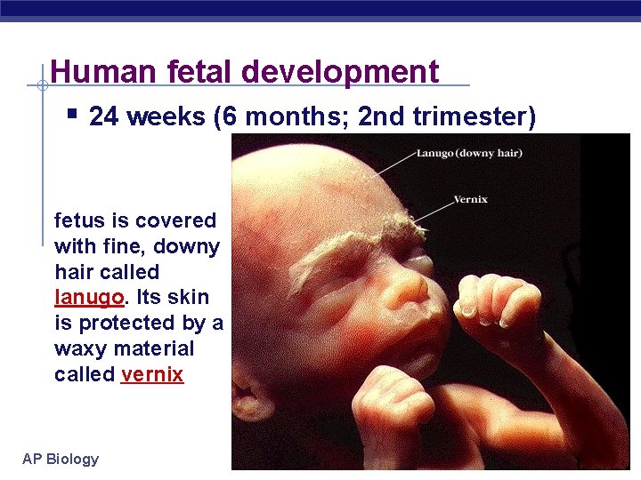 Human fetal development § 24 weeks (6 months; 2 nd trimester) fetus is covered