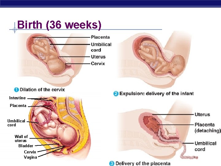 Birth (36 weeks) Intestine Placenta Umbilical cord Wall of uterus Bladder AP Cervix Vagina