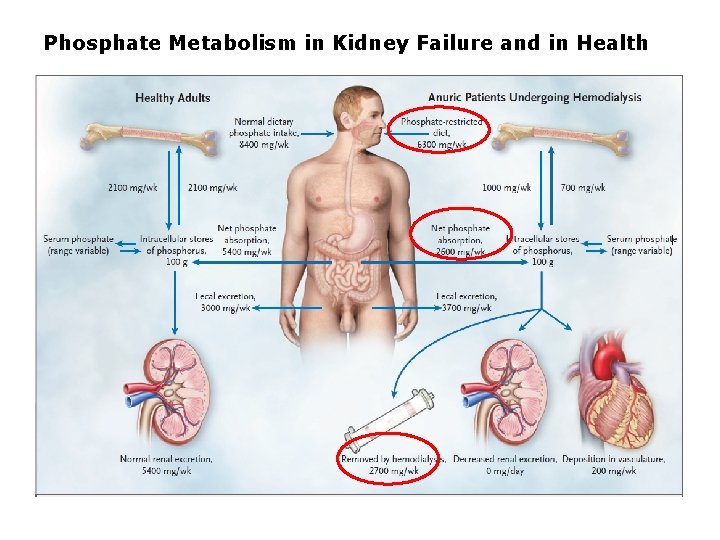 Phosphate Metabolism in Kidney Failure and in Health Phosphate Metabolism in Kidney Failure and in Health