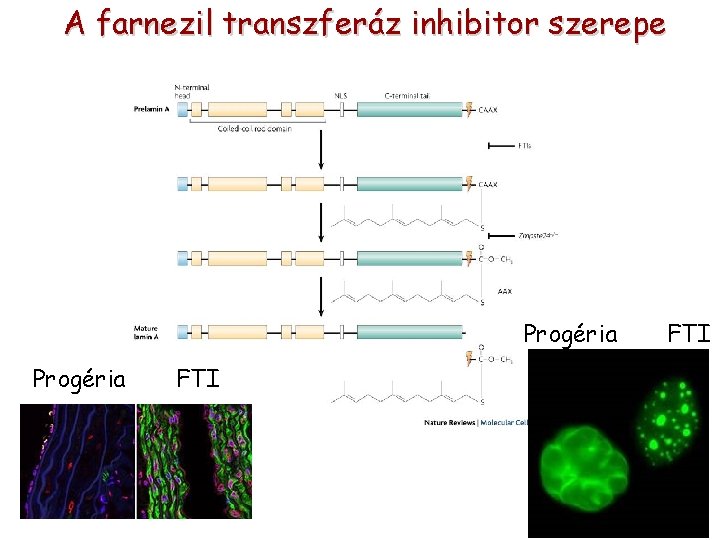 A farnezil transzferáz inhibitor szerepe Progéria FTI 