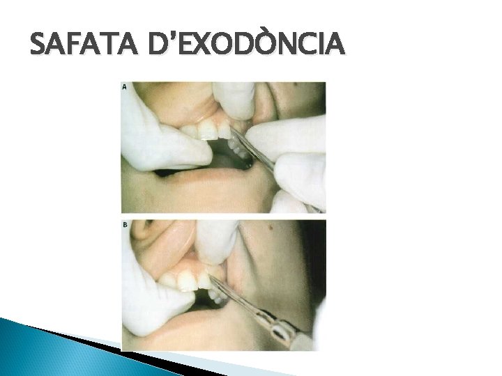 SAFATA D’EXODÒNCIA 