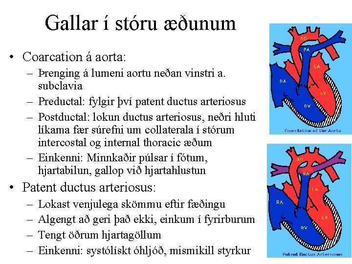 Gallar í stóru æðunum • Coarcation á aorta: – Þrenging á lumeni aortu neðan