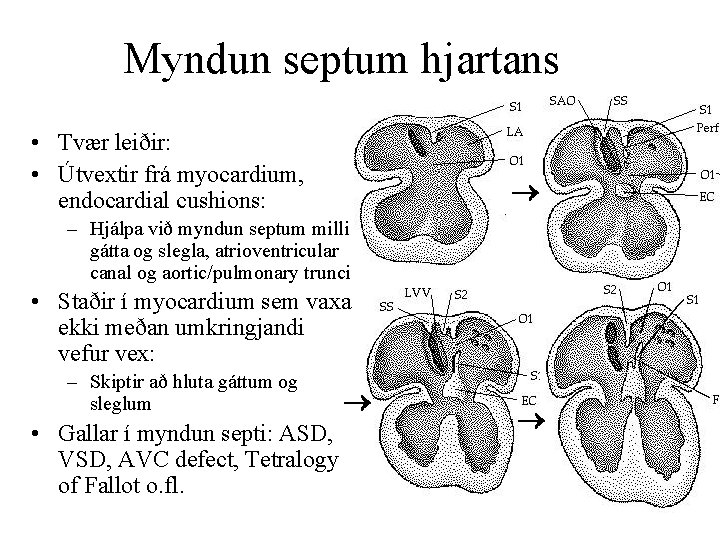Myndun septum hjartans • Tvær leiðir: • Útvextir frá myocardium, endocardial cushions: – Hjálpa