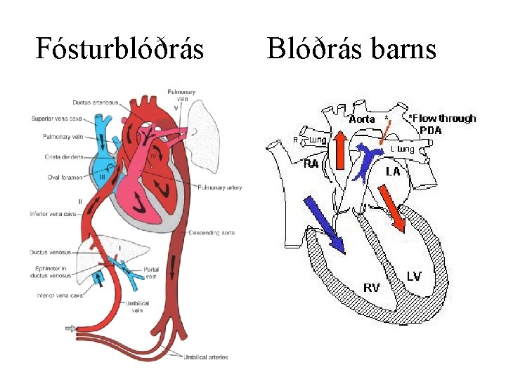 Fósturblóðrás Blóðrás barns • 