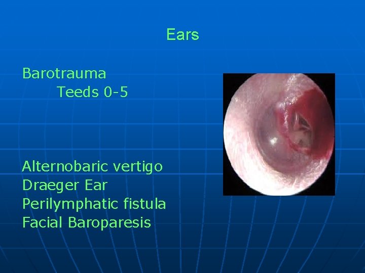 Diving Medicine LCdr Peter Hatfield Objectives Barotrauma