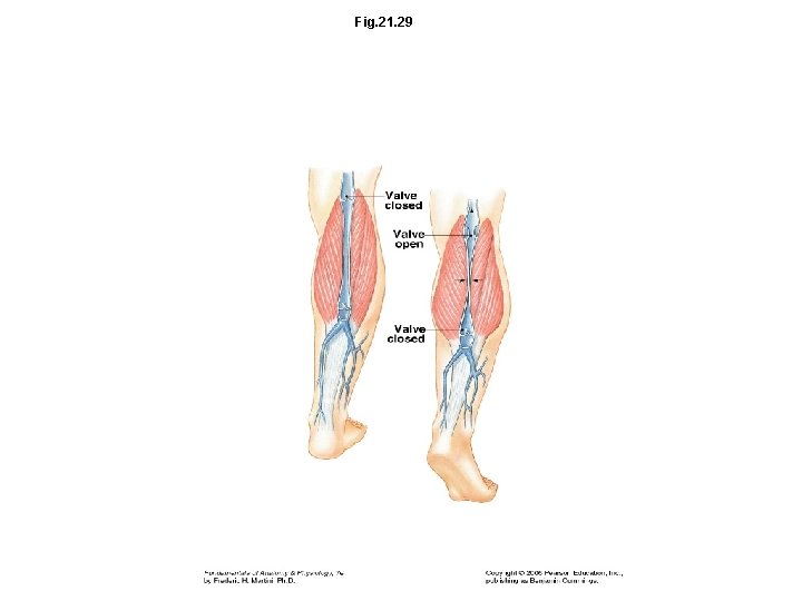 Fig. 21. 29 