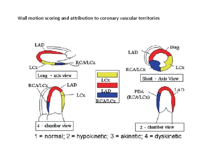 Wall motion scoring and attribution to coronary vascular territories 