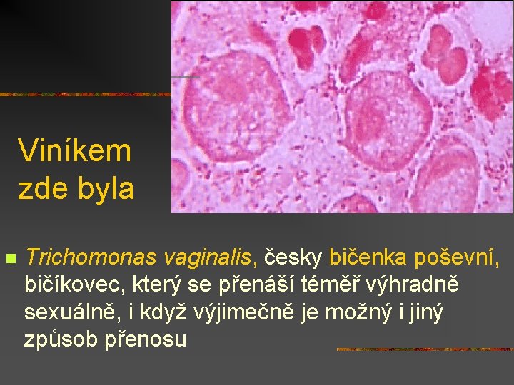 Viníkem zde byla n Trichomonas vaginalis, česky bičenka poševní, bičíkovec, který se přenáší téměř