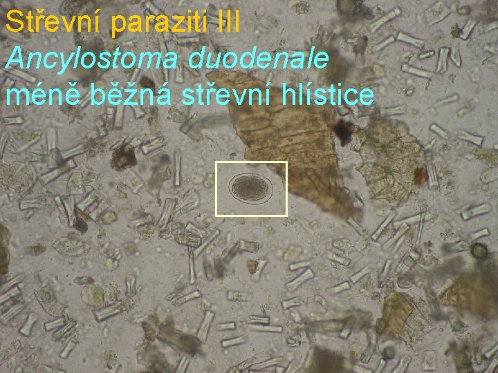 Střevní paraziti III Ancylostoma duodenale méně běžná střevní hlístice 