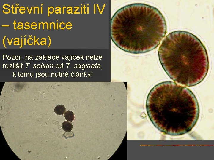 Střevní paraziti IV – tasemnice (vajíčka) Pozor, na základě vajíček nelze rozlišit T. solium