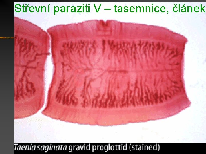 Střevní paraziti V – tasemnice, článek 