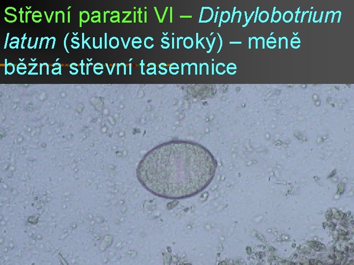 Střevní paraziti VI – Diphylobotrium latum (škulovec široký) – méně běžná střevní tasemnice 