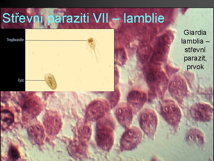 Střevní paraziti VII – lamblie Giardia lamblia – střevní parazit, prvok 