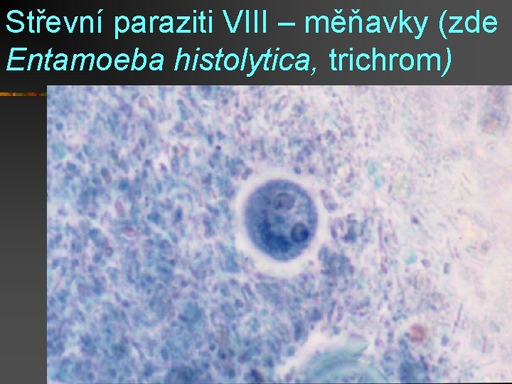 Střevní paraziti VIII – měňavky (zde Entamoeba histolytica, trichrom) 