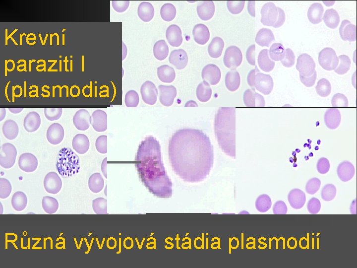 Krevní paraziti I (plasmodia) Různá vývojová stádia plasmodií 