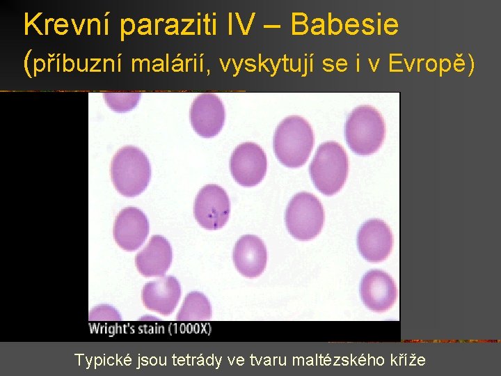 Krevní paraziti IV – Babesie (příbuzní malárií, vyskytují se i v Evropě) Typické jsou