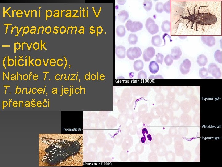 Krevní paraziti V Trypanosoma sp. – prvok (bičíkovec), Nahoře T. cruzi, dole T. brucei,