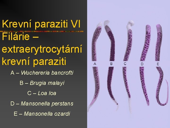 Krevní paraziti VI Filárie – extraerytrocytární krevní paraziti A – Wuchereria bancrofti B –
