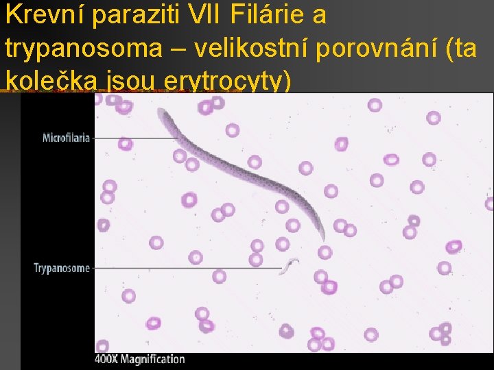 Krevní paraziti VII Filárie a trypanosoma – velikostní porovnání (ta kolečka jsou erytrocyty) 