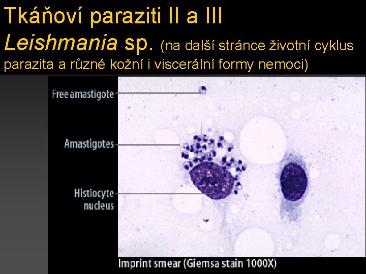 Tkáňoví paraziti II a III Leishmania sp. (na další stránce životní cyklus parazita a