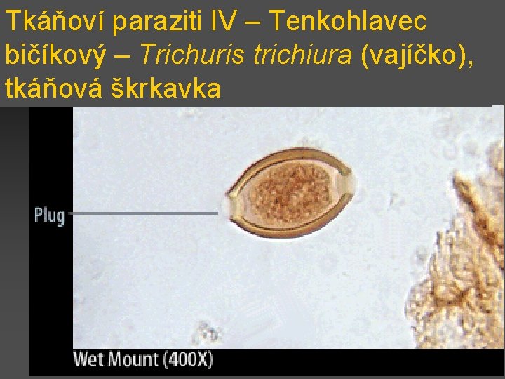 Tkáňoví paraziti IV – Tenkohlavec bičíkový – Trichuris trichiura (vajíčko), tkáňová škrkavka 