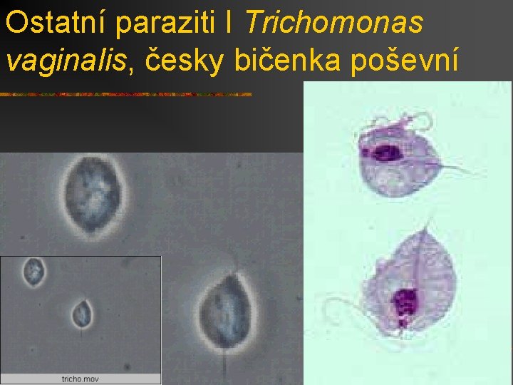 Ostatní paraziti I Trichomonas vaginalis, česky bičenka poševní 