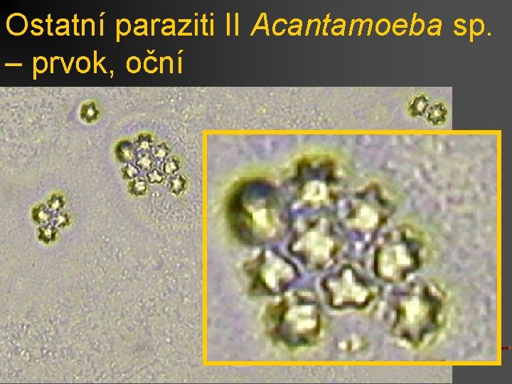 Ostatní paraziti II Acantamoeba sp. – prvok, oční 
