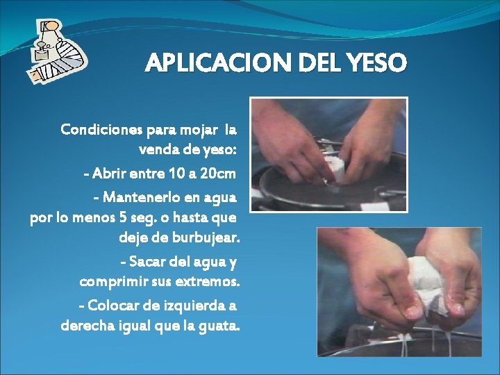 APLICACION DEL YESO Condiciones para mojar la venda de yeso: - Abrir entre 10