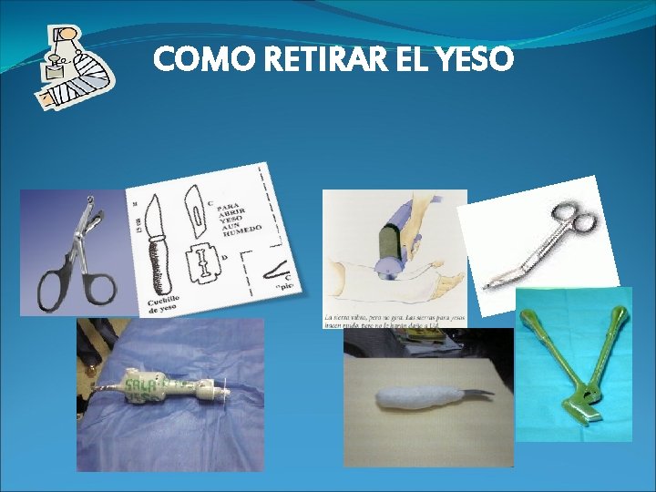 COMO RETIRAR EL YESO Cuando esta Mojado Cuando esta seco 