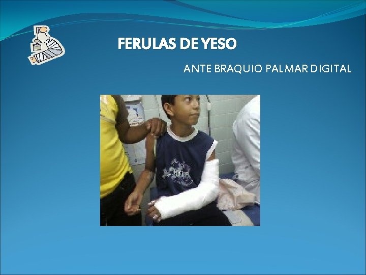 FERULAS DE YESO ANTE BRAQUIO PALMAR DIGITAL 