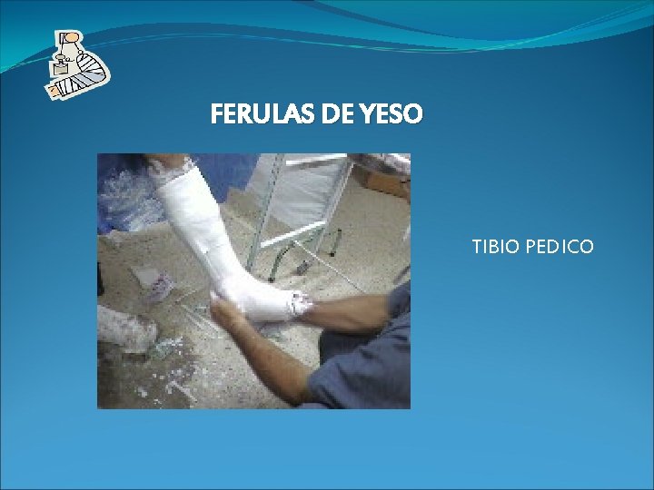 FERULAS DE YESO TIBIO PEDICO 