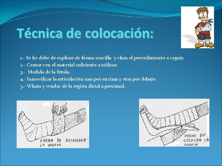 Técnica de colocación: 1. - Se les debe de explicar de forma sencilla y