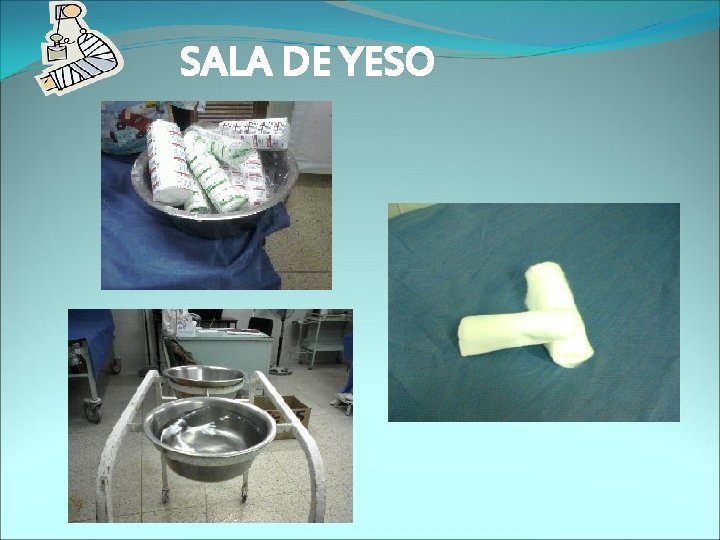 SALA DE YESO 