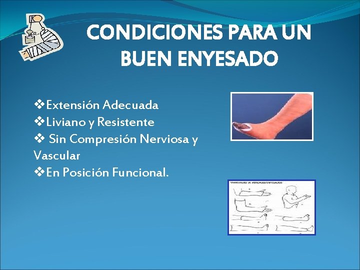 CONDICIONES PARA UN BUEN ENYESADO v. Extensión Adecuada v. Liviano y Resistente v Sin