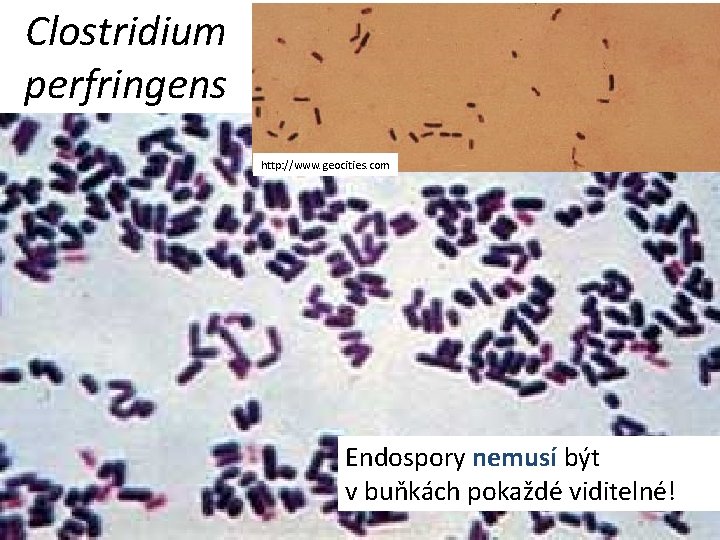 Clostridium perfringens http: //www. geocities. com Endospory nemusí být v buňkách pokaždé viditelné! 