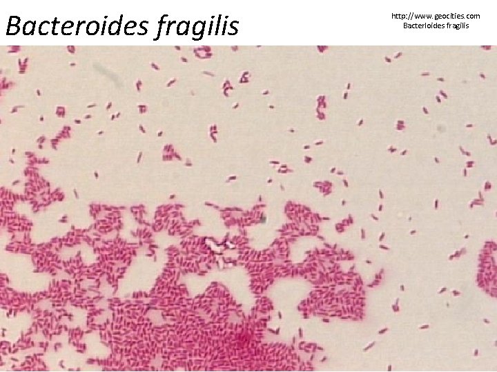 Bacteroides fragilis http: //www. geocities. com Bacterloides fragilis 