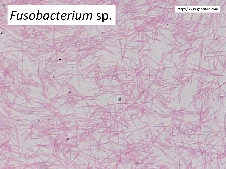 Fusobacterium sp. http: //www. geocities. com 