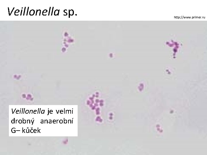 Veillonella sp. Veillonella je velmi drobný anaerobní G– kůček http: //www. primer. ru 