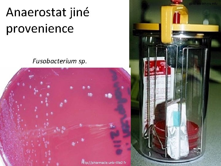 Anaerostat jiné provenience Fusobacterium sp. http: //pharmacie. univ-lille 2. fr gold. aecom. yu. edu