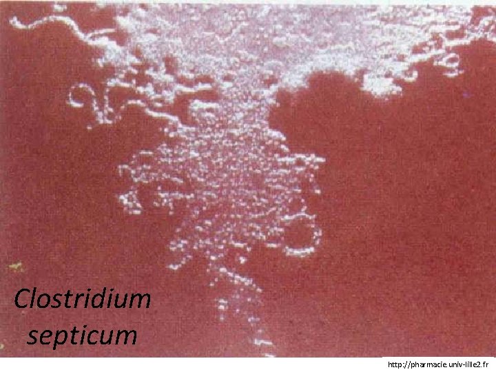 Clostridium septicum http: //pharmacie. univ-lille 2. fr 