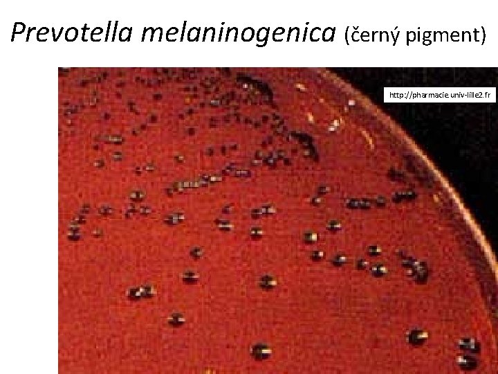 Prevotella melaninogenica (černý pigment) http: //pharmacie. univ-lille 2. fr 