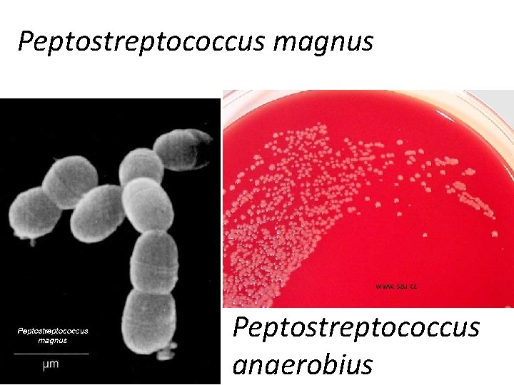 Peptostreptococcus magnus www. zuova. cz www. szu. cz Peptostreptococcus anaerobius 