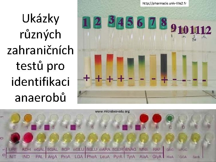 http: //pharmacie. univ-lille 2. fr Ukázky různých zahraničních testů pro identifikaci anaerobů www. microbes-edu.